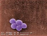 Universal treatment heads off ICU MRSA