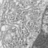 Infection protocols contain hospital-acquired MERS outbreak in Saudi Arabia