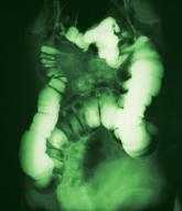 Medicolegal Lessons: A question of duty