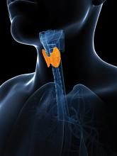 Thyroid cancer rise mostly overdiagnosis