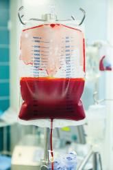 Transfusions Worsen Outcomes After Colorectal Cancer Surgery
