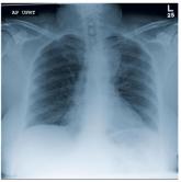 Woman With Back Pain Unable To Walk