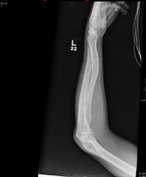 Man Run Over By Vehicle