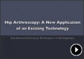 Hip Arthroscopy: A New Application of an Existing Technology