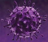 Management of HIV/AIDS