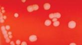 CDC okays group meningitis vaccination in emergency