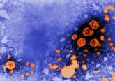 Preventing, treating HBV reactivation during immunosuppressive therapy