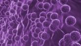 Ribavirin dose reduction, erythropoietin combat HCV anemia