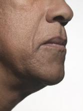 Smelling test makes progress in identifying preclinical Alzheimer’s