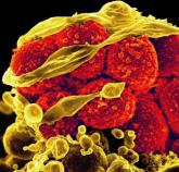 Tedizolid found noninferior to linezolid for complicated skin infections 