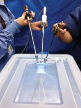 Single port laparoscopic hysterectomy