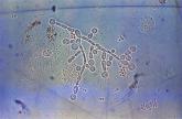 New Candida species isolated in U.S.