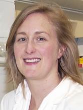 Whole exome sequencing finds TREX1 mutation in a child with cerebral lupus