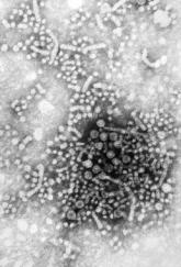 Sofosbuvir combo effective in unresponsive HCV