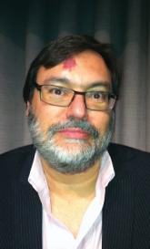 Rasagiline’s failure as active control halts phase III preladenant trial