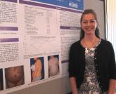 The chicken or the egg: Obesity or psoriasis?