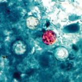 CDC investigates Cyclospora outbreak
