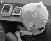 Potential of transcranial direct current stimulation shown in fibromyalgia