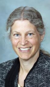 For successful inpatient video EEG monitoring, timing is everything