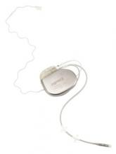 CPAP alternative? Implantable device cut OSA severity