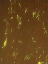 Newly described tick-borne infection found in New England