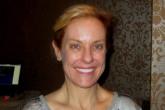 Women’s Sexuality Diminished by Psoriasis