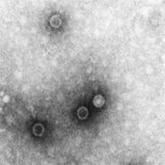 Poliomyelitis outbreak in China controlled rapidly