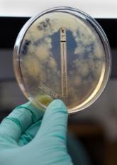 Fungal meningitis can masquerade as ischemic stroke