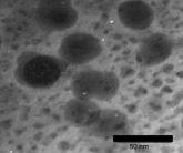 Nanoparticles take aim at acne
