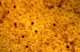 Age, risk factors should guide chlamydia, gonorrhea screening of HIV-infected women