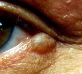 Eye Can’t See a Thing Eye Can’t See a Thing