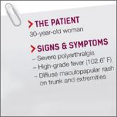 Severe polyarthralgia, high-grade fever, diffuse maculopapular rash on trunk and extremities • Dx?