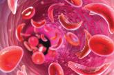Sickle cell