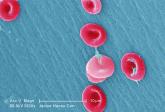 SelG1 cut pain crises in sickle cell disease
