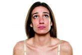 Females with acne stay on spironolactone longer than antibiotics in real-world usage study