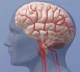 Stroke hospitals owe all patients rapid thrombolysis