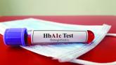 EMR screening in emergency department tags undiagnosed diabetes