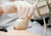Do dense breasts affect the risk of developing breast cancer