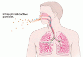 Radon and lung cancer: Assessing and mitigating the risk