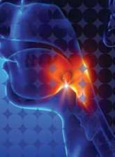 Deep Space Infections of the Neck: Considerations in Diagnosis and Management
