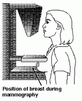 Screening mammography starting at age 40: Still relevant