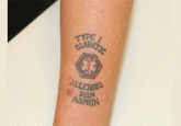 Tattooing: Medical uses and problems