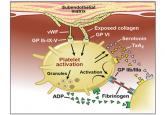 Dual antiplatelet therapy for acute coronary syndromes: How long to continue?