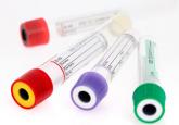 Approach to asymptomatic creatine kinase elevation
