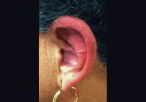 Miss the ear, and you may miss the diagnosis