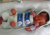 Protecting the newborn brain—the final frontier in obstetric and neonatal care