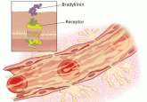Recognizing and managing hereditary angioedema