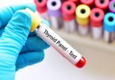 Subclinical hypothyroidism: When to treat