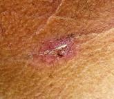 Don’t Just Look at the Lesion Don’t Just Look at the Lesion