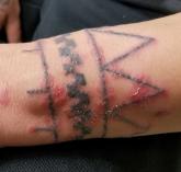 Wrist tattoo with rash Wrist tattoo with rash